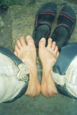 Fe mit Wunden und Blasen